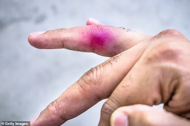 Alberta Court Dismisses Rare Lawsuit Between Minors Over Daycare Toy Incident