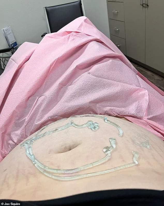 Texas Laws and the Complex Reality of Transgender Individuals: Navigating Parenthood and Public Policy