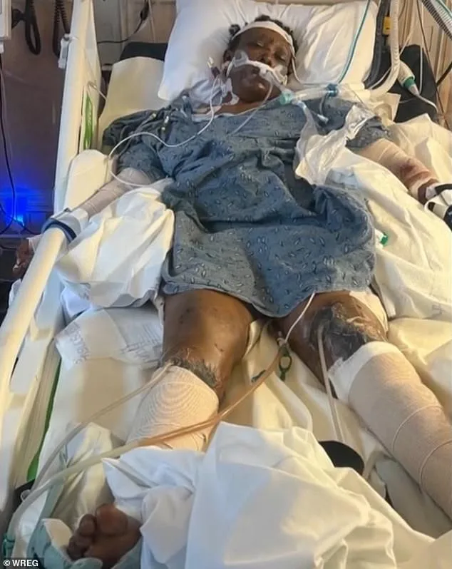 Holly Springs Mother Survives Brutal Dog Attack with Severe Injuries